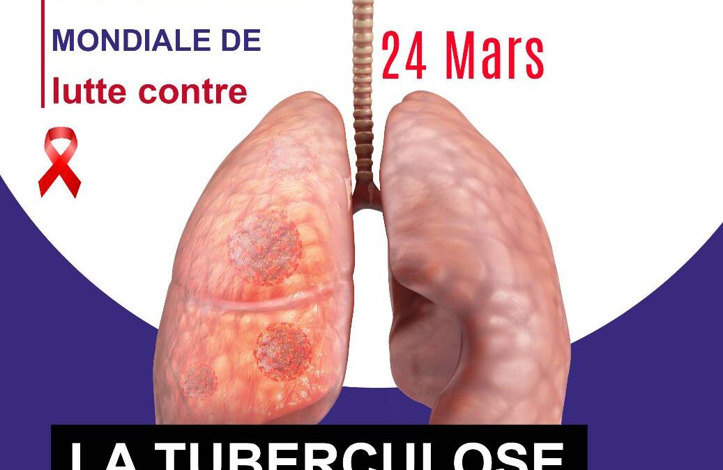 Journée mondiale de lutte contre la Tuberculose